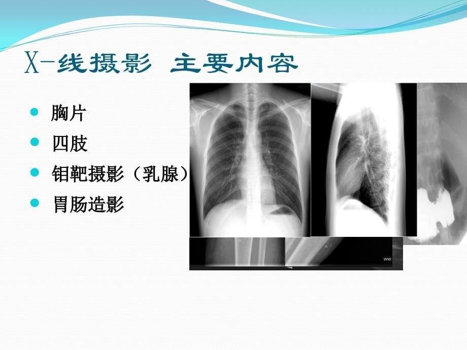 合理选择影像检查方法_第5页