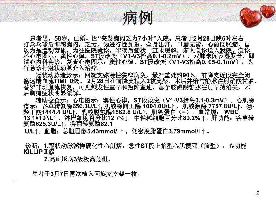 急性心肌梗死PPT演示课件_第2页