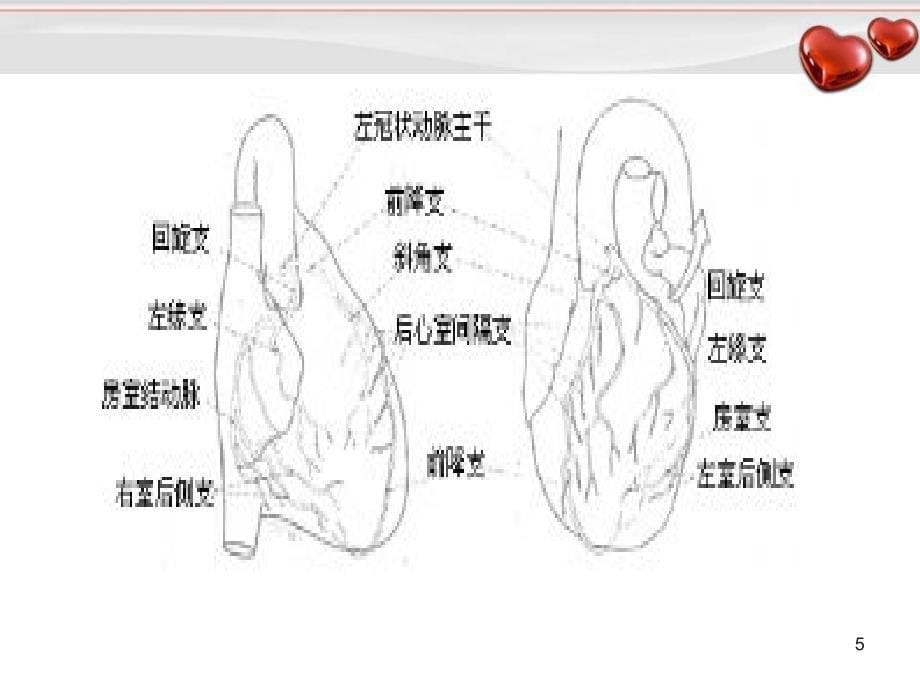 急性心肌梗死PPT演示课件_第5页