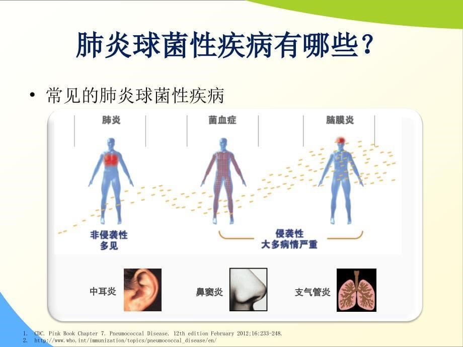 慢性病患者更易发生肺炎球菌感染课件_第5页