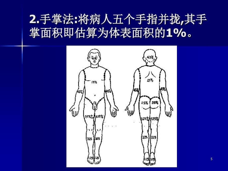 急性烧烫伤的急救参考PPT_第5页