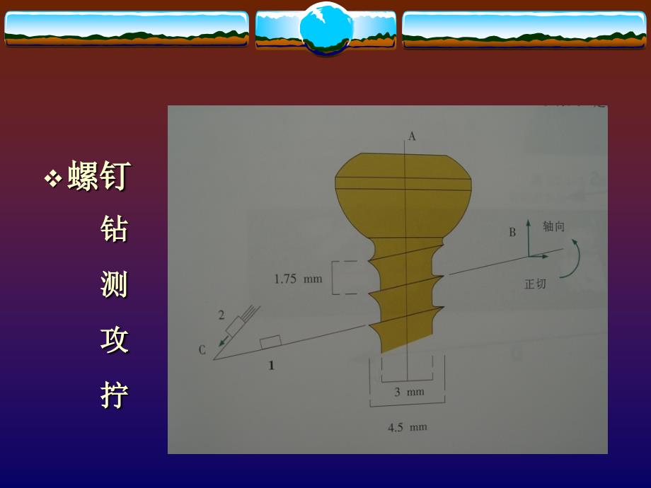 钢板及螺钉固定的基本操作原则.ppt_第2页