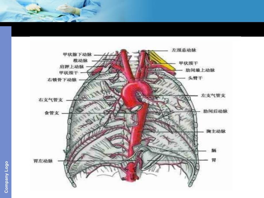 主动脉夹层护理查房课件_第4页