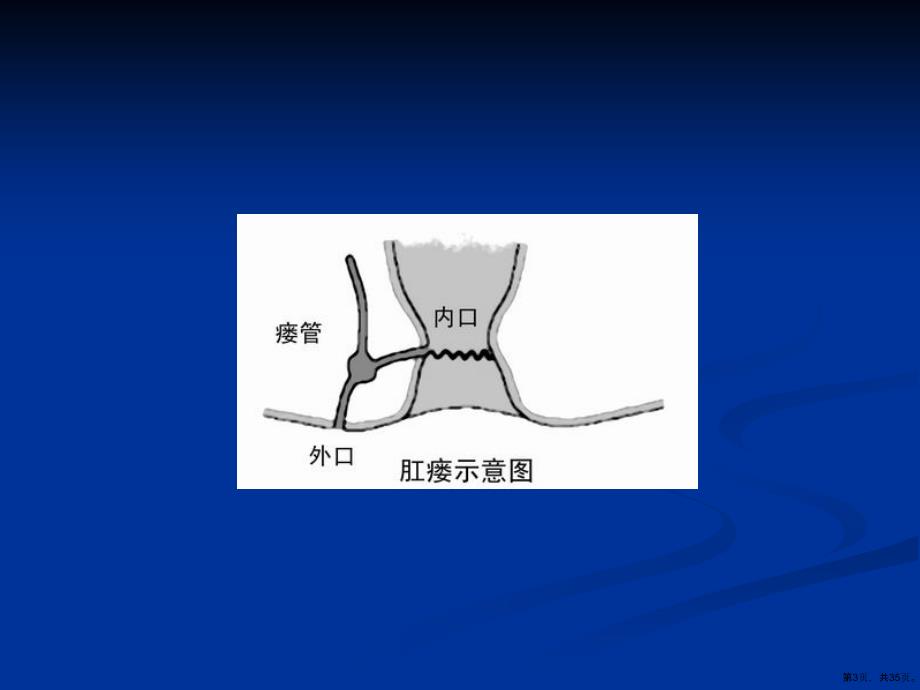 《肛瘘手术》教学课件_第3页