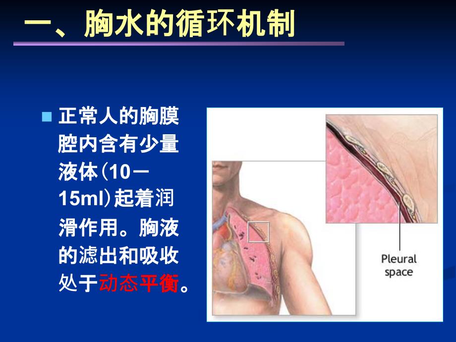 胸腔积液-教学查房.ppt_第4页