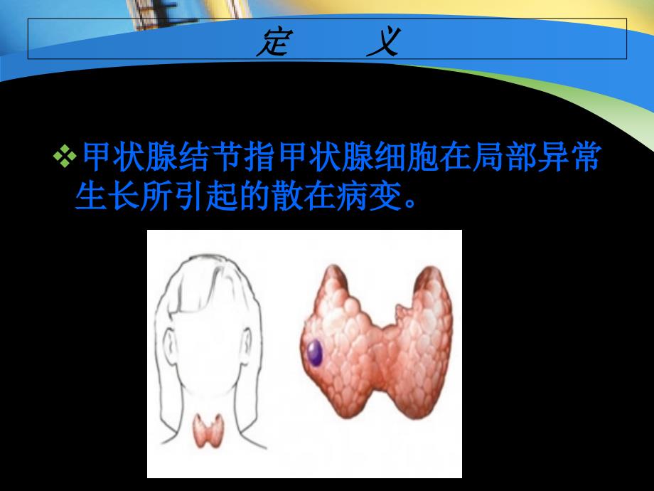 甲状腺结节诊治指南29页PPT文档_第3页