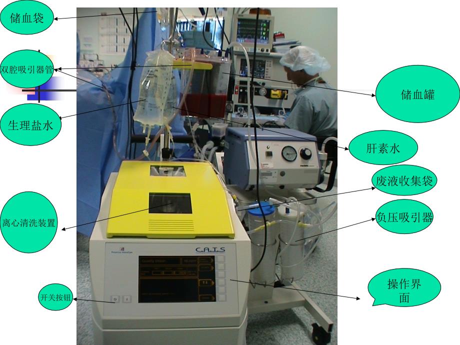 费森尤斯自体血回收机的使用及注意事项课件_第2页