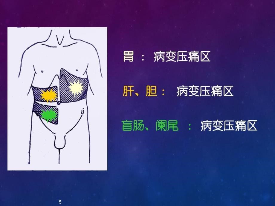 （医学课件）腹痛刘曙光.ppt_第5页