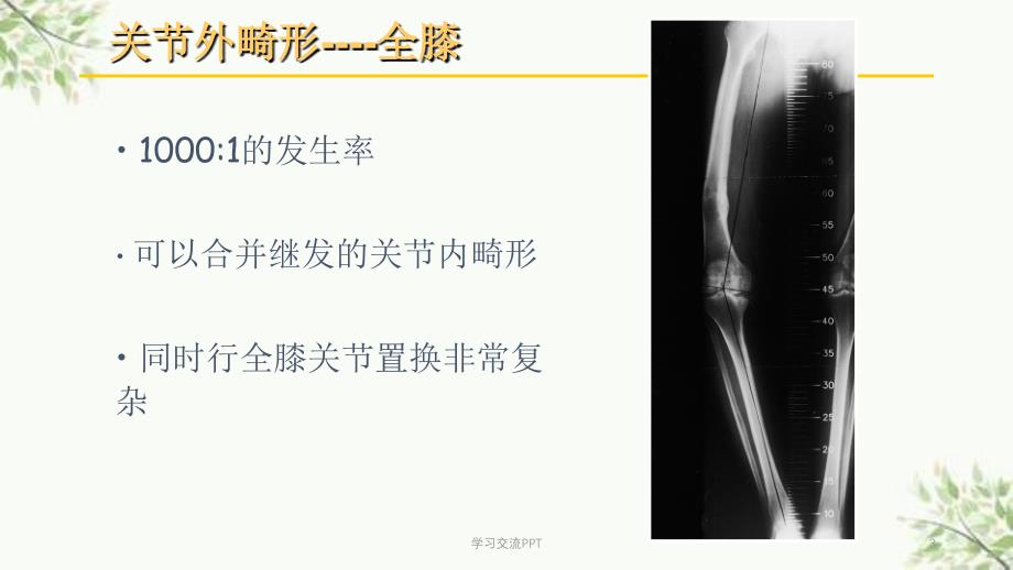 关节外畸形全膝医学课件_第3页