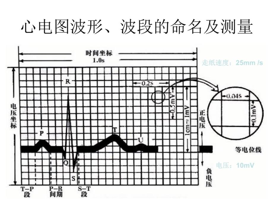 第六讲心律失常课件ppt课件_第4页