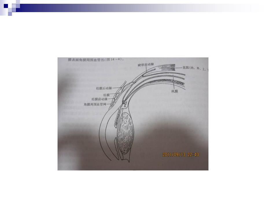 眼科学课件：结膜炎_第4页