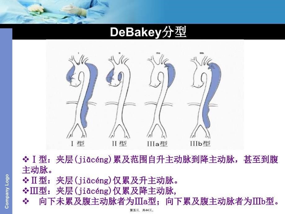 主动脉夹层护理查房(1)复习过程_第5页