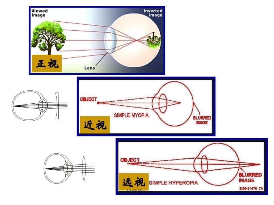 视觉器官课件_第5页