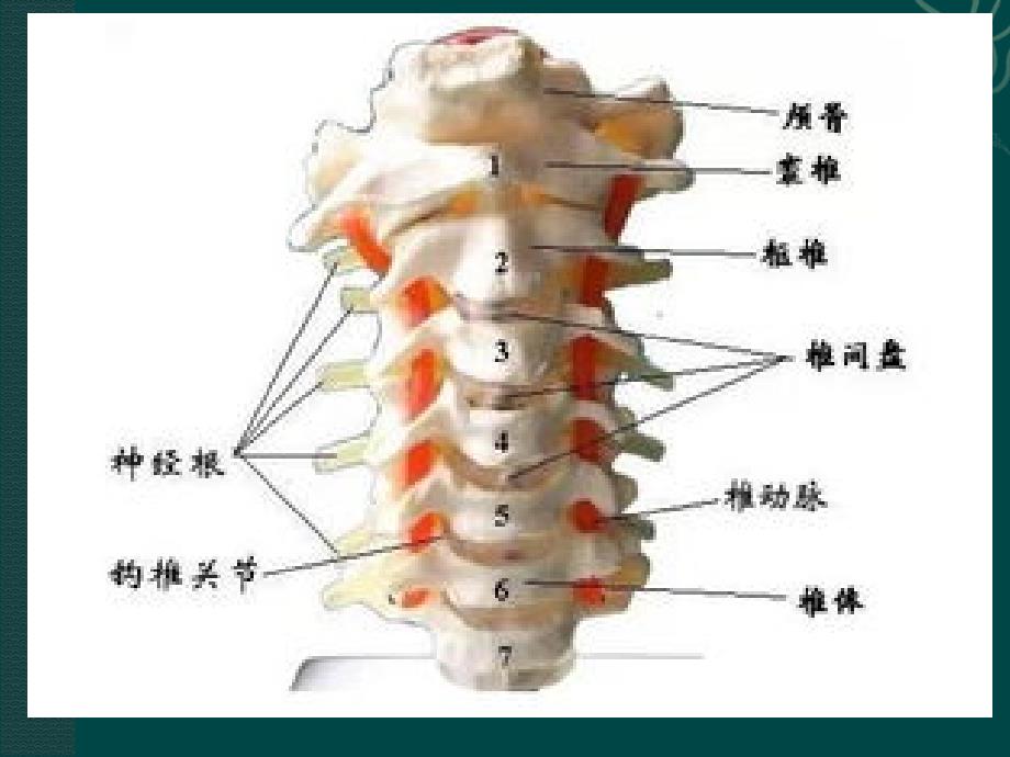 颈椎病诊疗及康复锻炼ppt课件_第4页