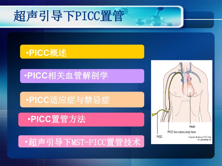 超声引导PICC置管ppt课件_第2页