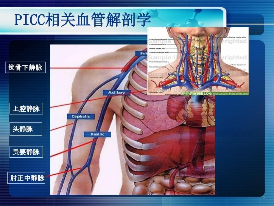 超声引导PICC置管ppt课件_第5页