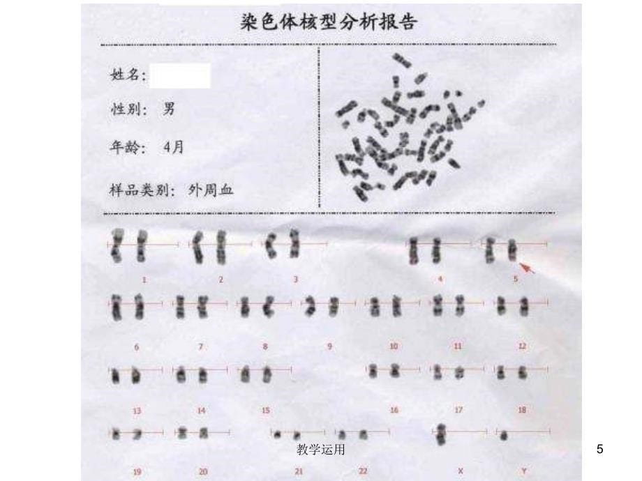 性染色体与伴性遗传ppt高教课堂_第5页