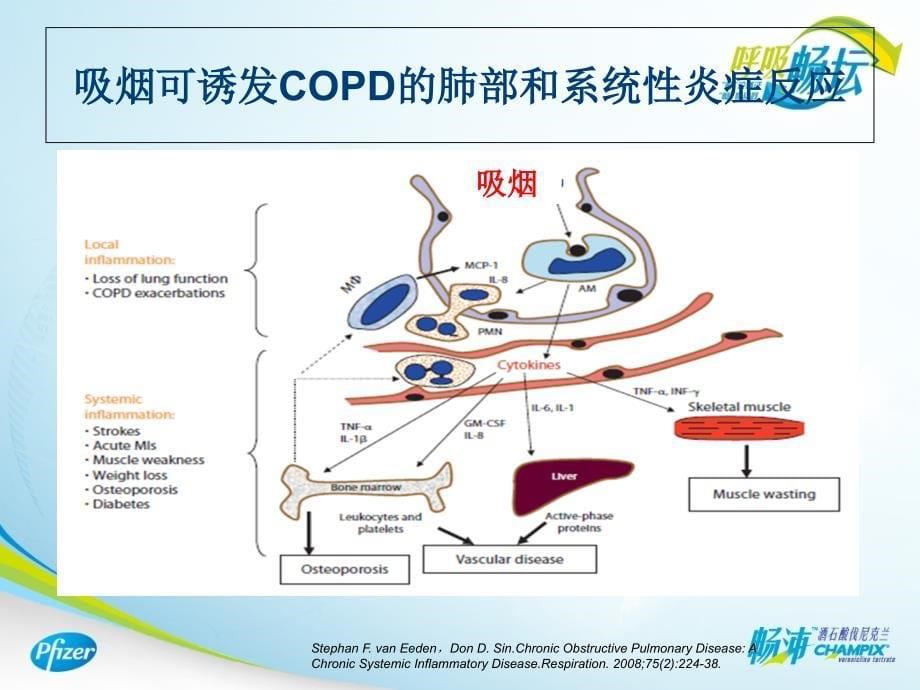 戒烟治疗与COPD_第5页