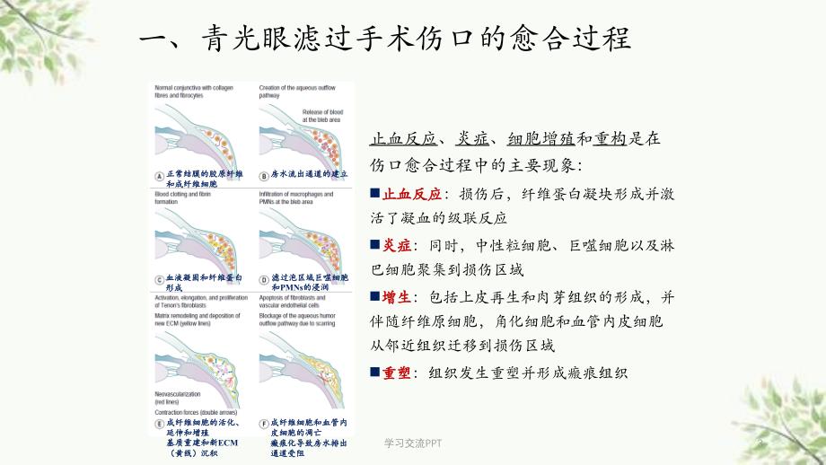 功能性滤过泡的维护课件_第3页