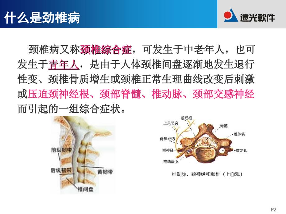 如何预防劲椎病PPT优秀课件_第2页