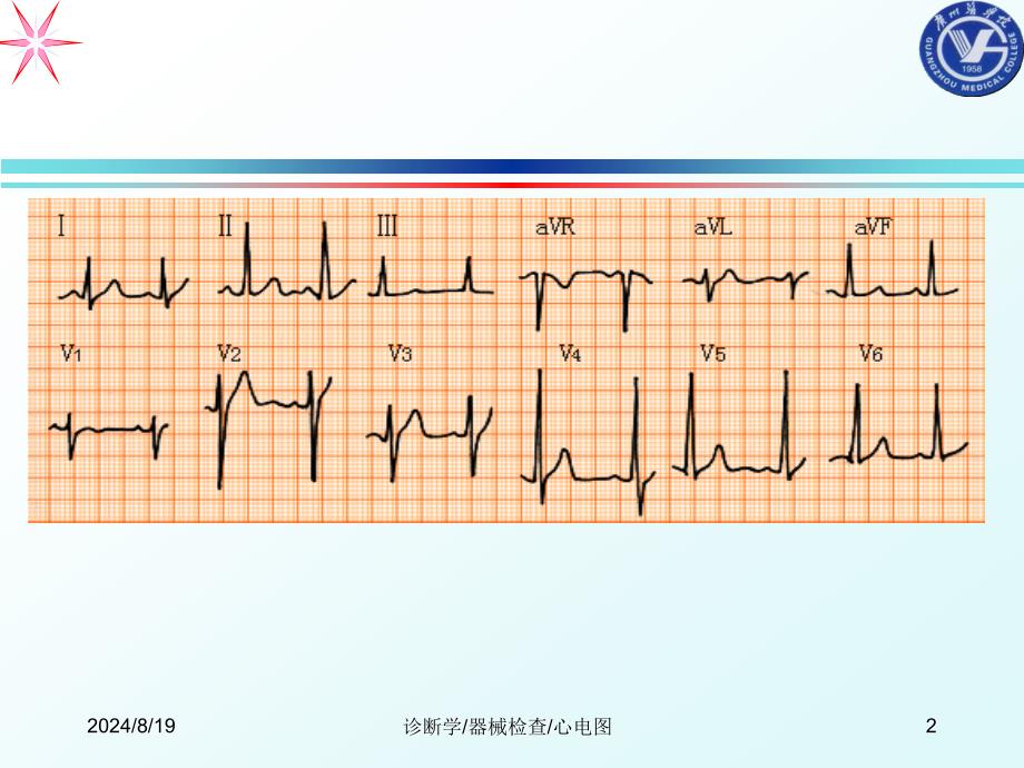 心电图完美课件ppt课件_第2页