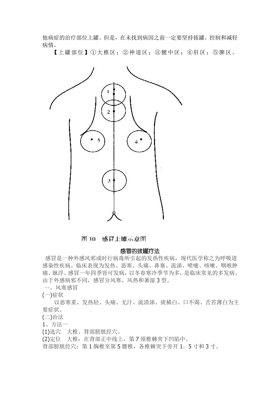 感冒拔罐疗法.doc_第2页