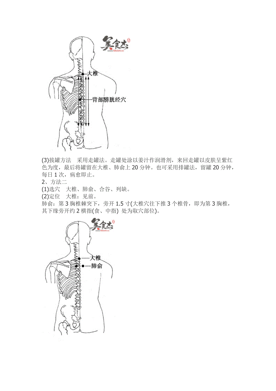 感冒拔罐疗法.doc_第3页