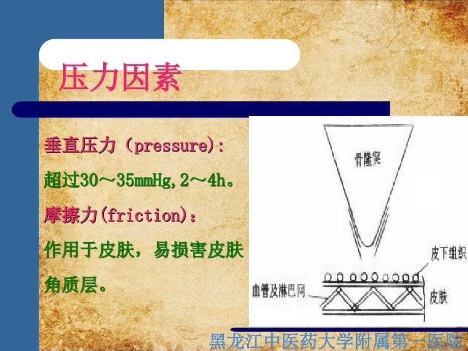 《压疮的预防和护理》课件_第5页