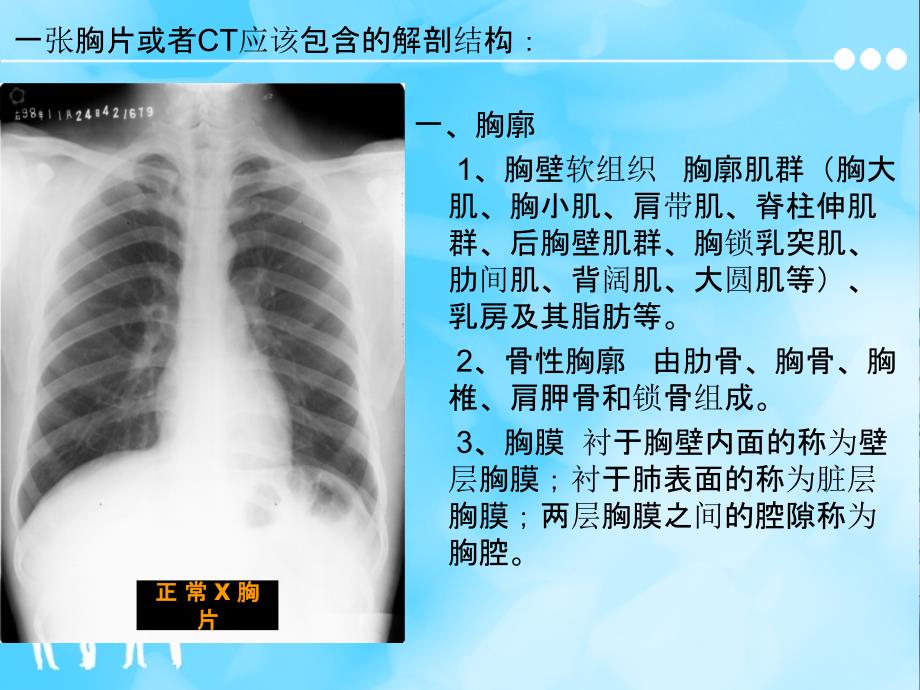 胸片及胸部CT的阅读内容及肺段定位ppt课件_第2页