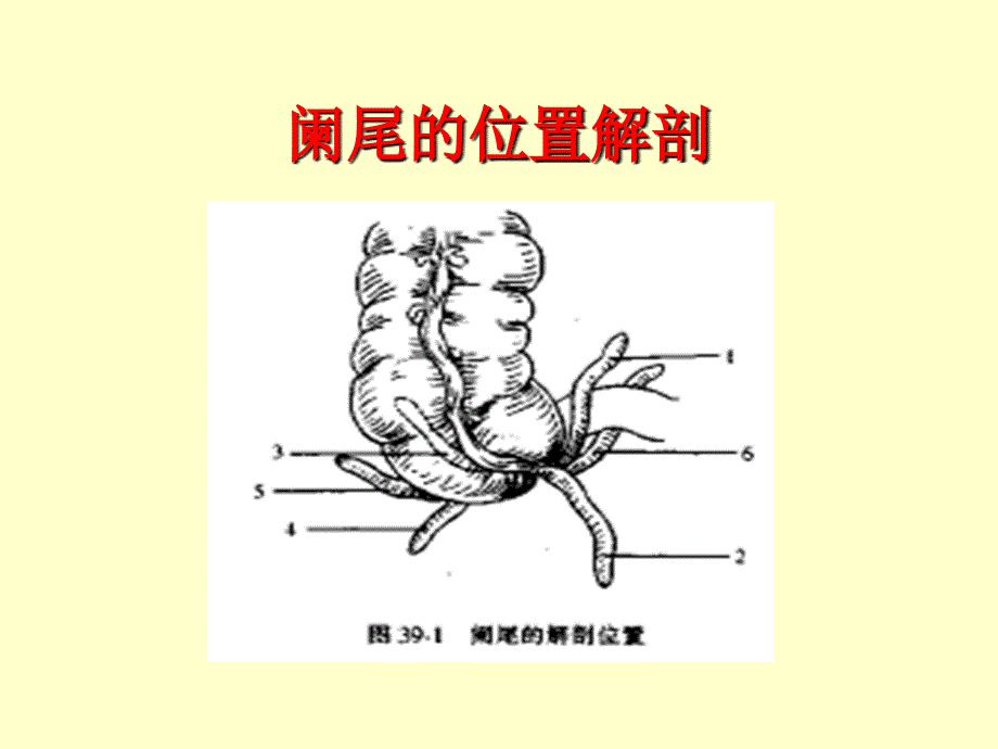 实用阑尾炎PPT课件_第4页