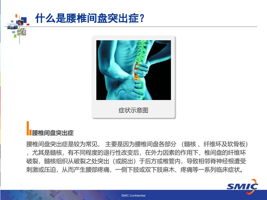 腰椎间盘突出症科普介绍_第2页