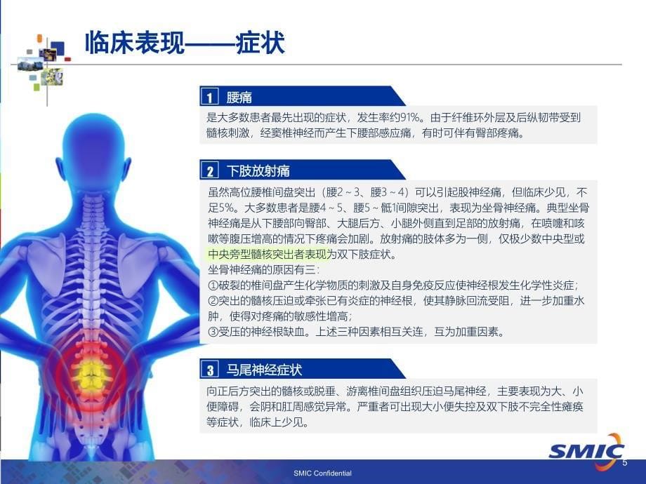 腰椎间盘突出症科普介绍_第5页