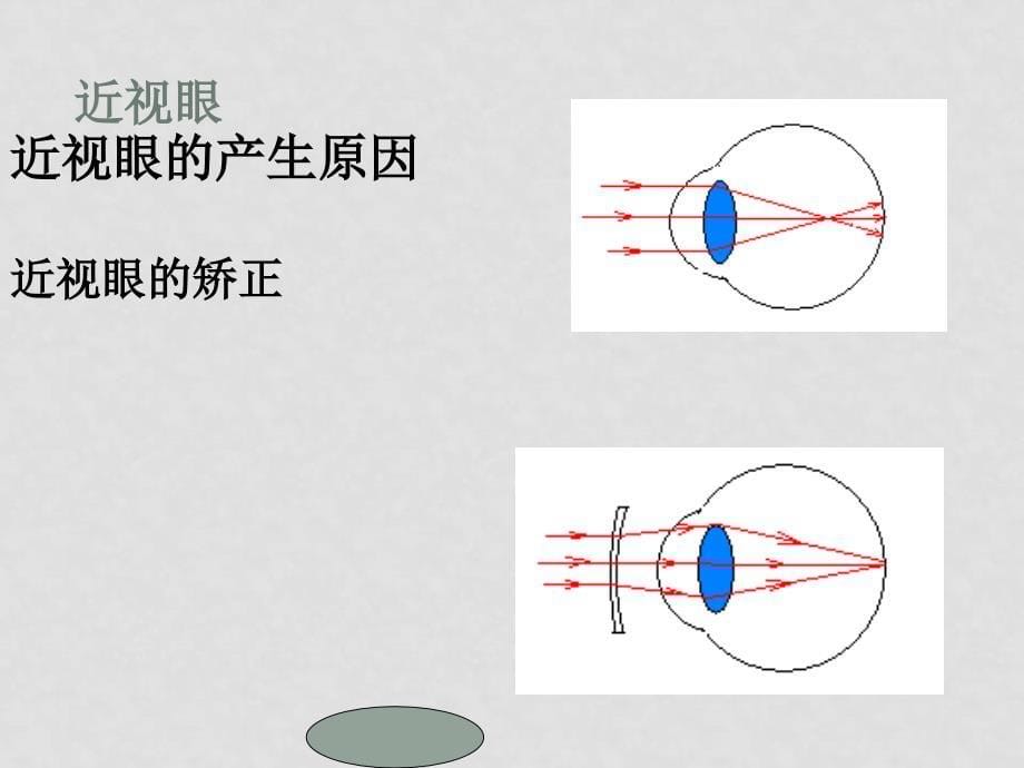 八年级物理眼睛和眼镜课件人教版_第5页