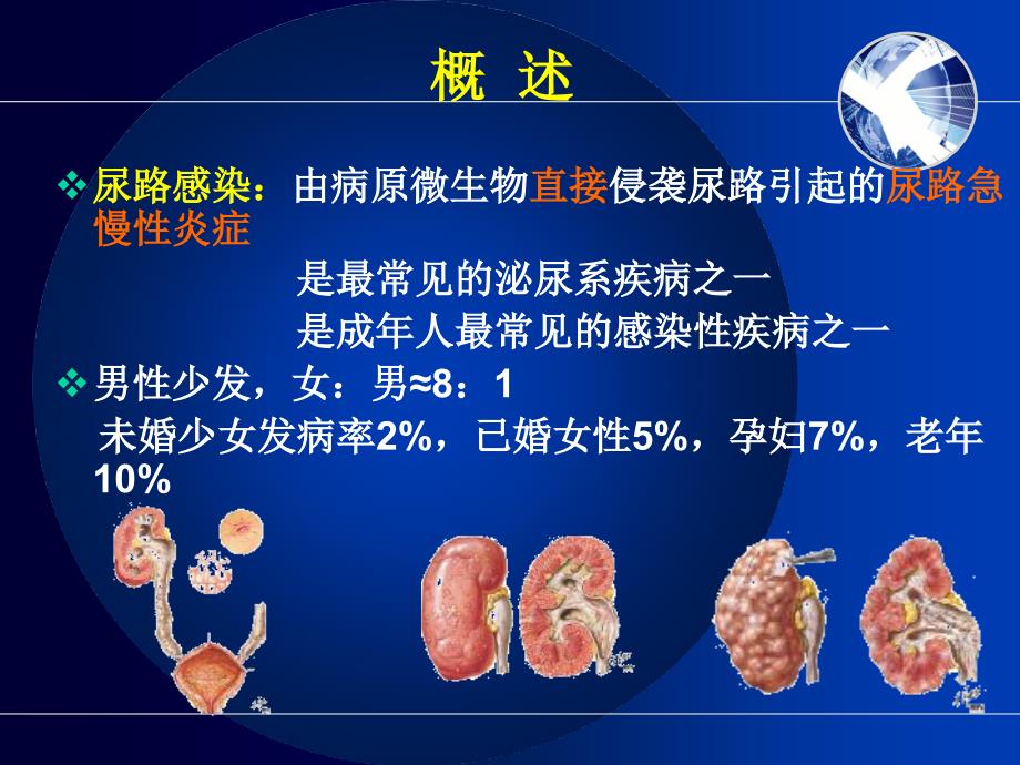 尿路感染护理非常全面_第3页