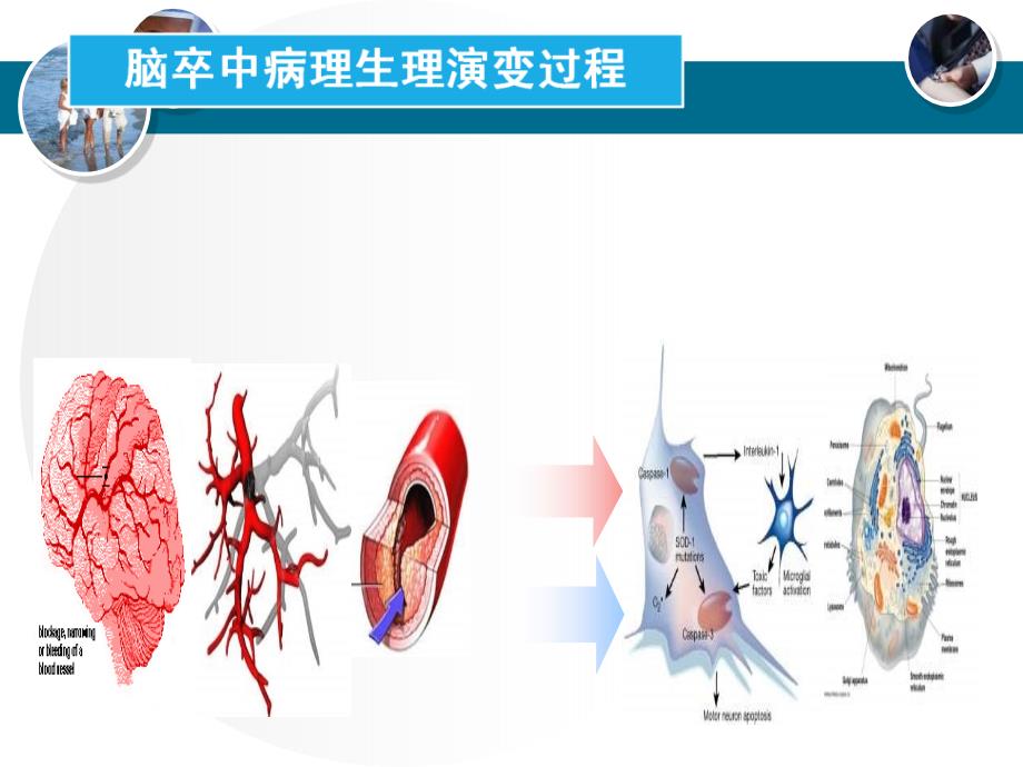 急性脑梗塞的病理生理与治疗策略_第3页