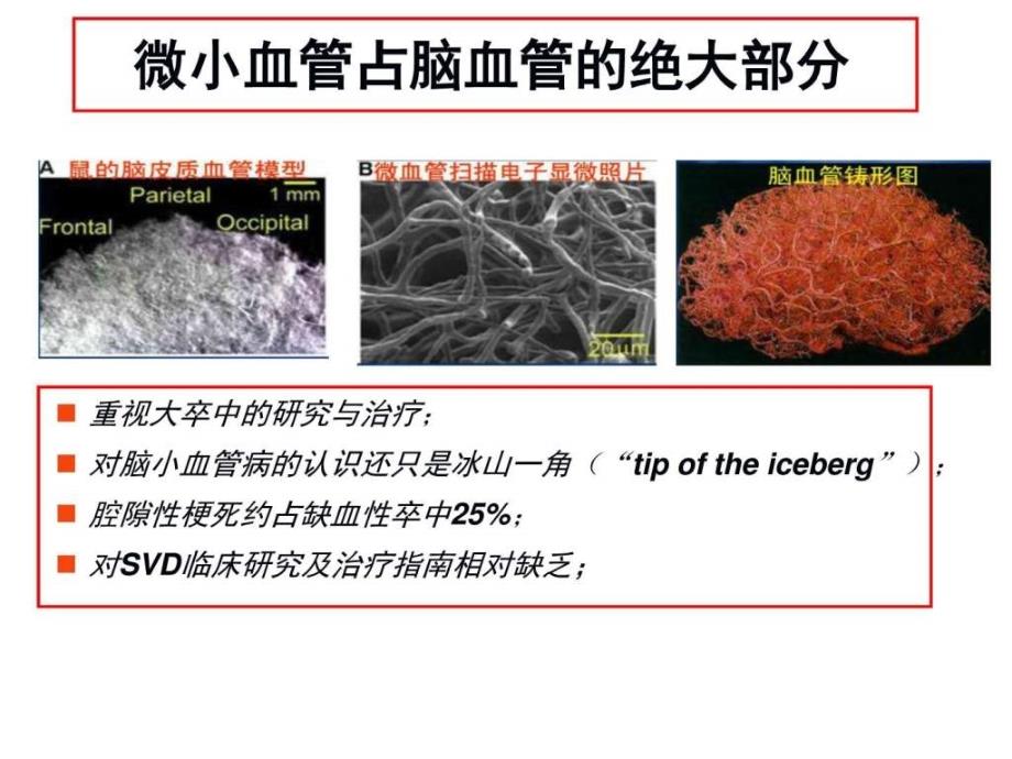 小血管病PPT课件_第3页