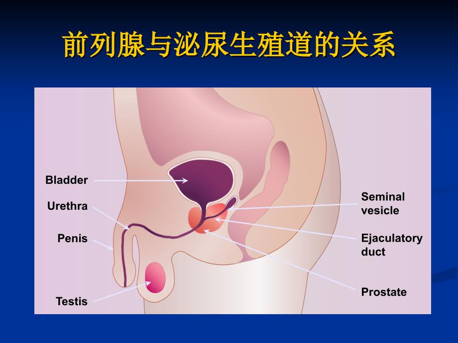 良前列腺增生病人的护理BenignProstaticHyperplasia_第4页