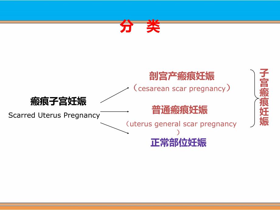 f瘢痕妊娠ppt课件_第4页