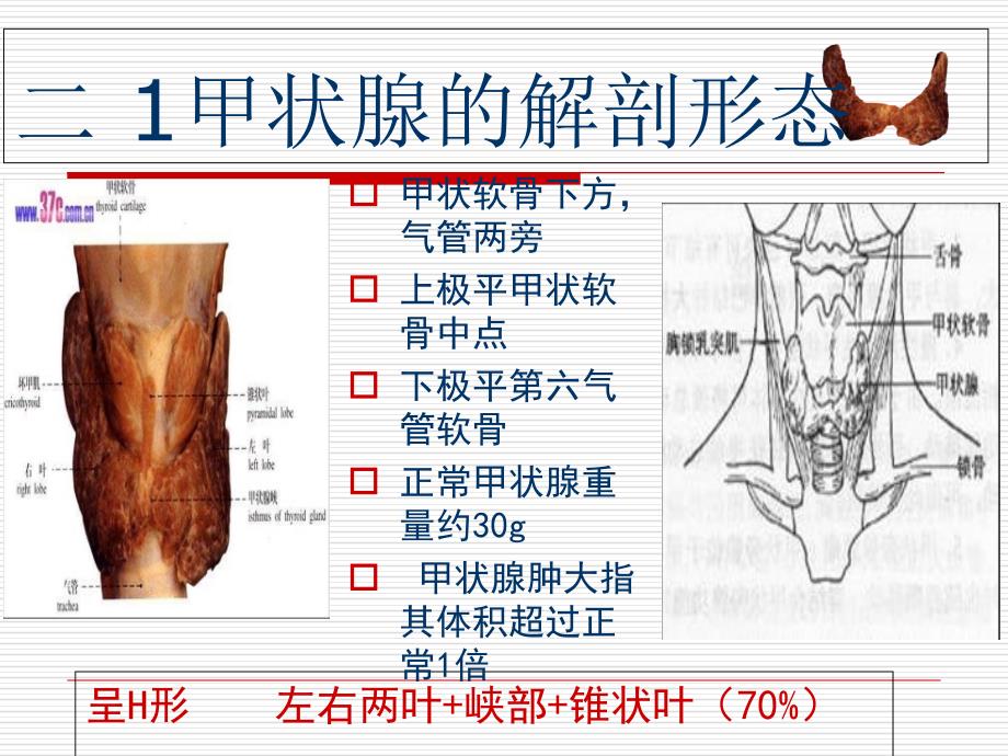 甲状腺肿瘤的护理PPT文档_第2页