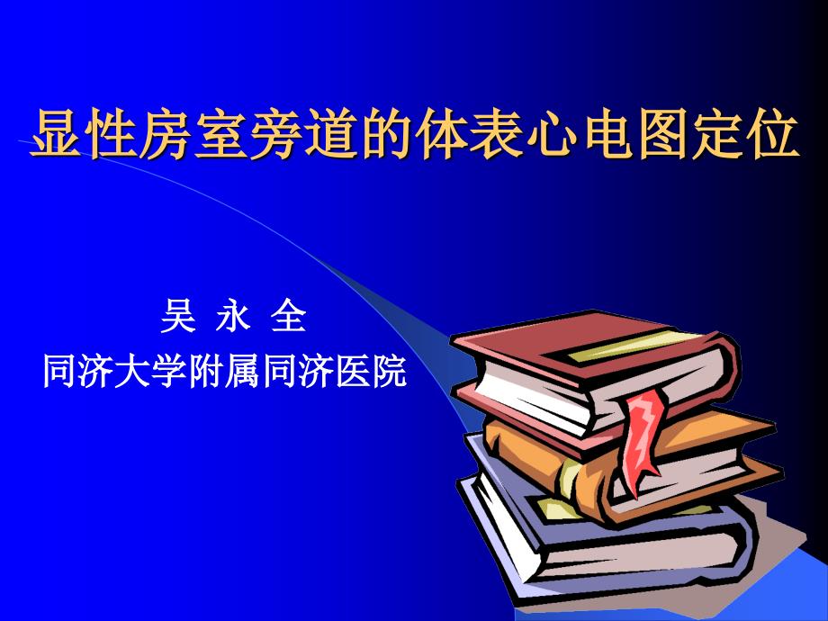 显性房室旁道的体表心电图定位_第1页