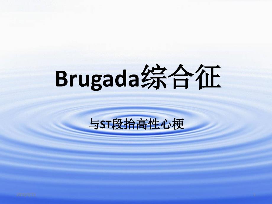 Brugada综合征ppt参考课件_第1页