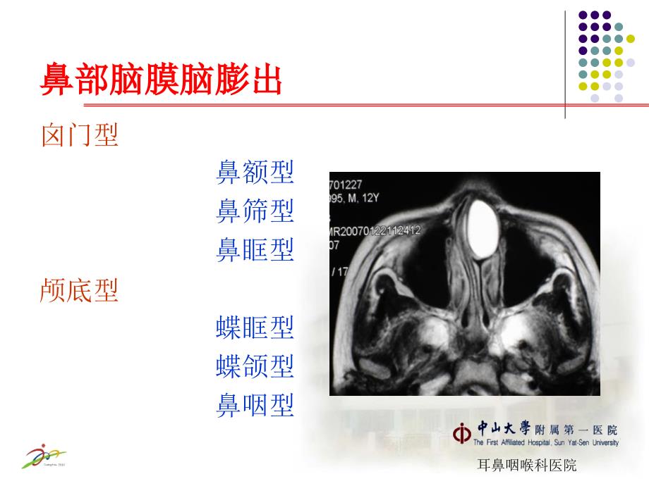 鼻部先天性疾病83_第4页