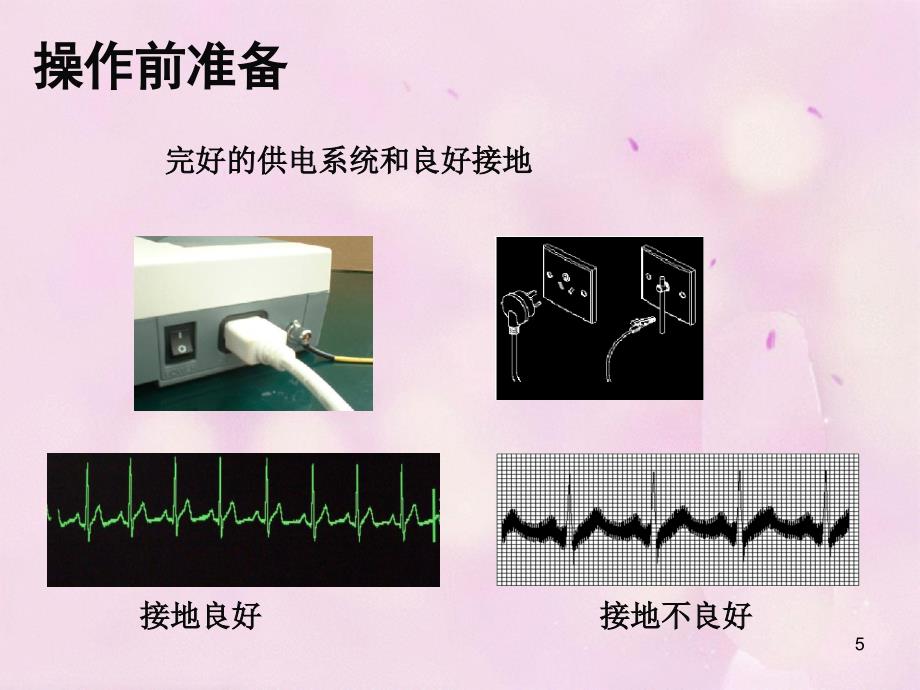 心电监护仪的使用和报警处理ppt参考课件_第4页