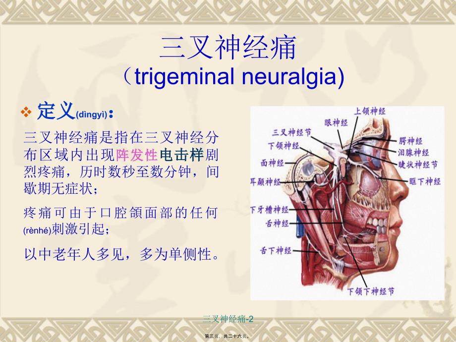 三叉神经痛2课件_第3页