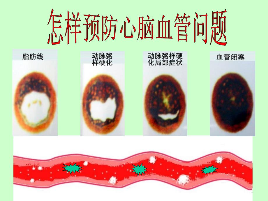 怎样清洗血管PPT课件_第1页