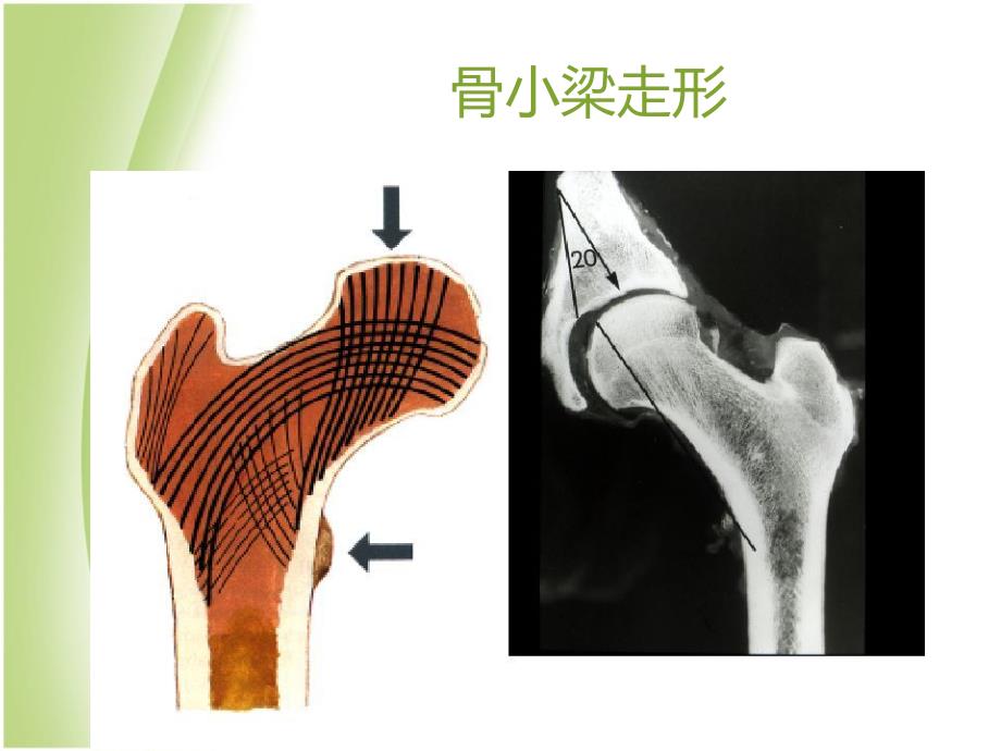 股骨颈骨折从解剖到手术的全面阐述_第2页