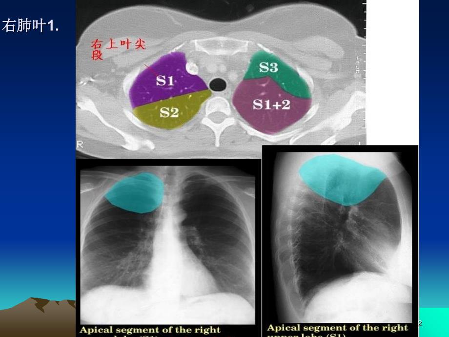 CT正常彩色解剖图肺段演示PPT_第2页