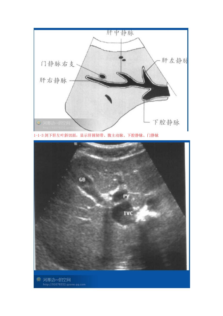 20个肝脏超声切面你常用哪几种切面来应对肝脏方面的检查_第4页