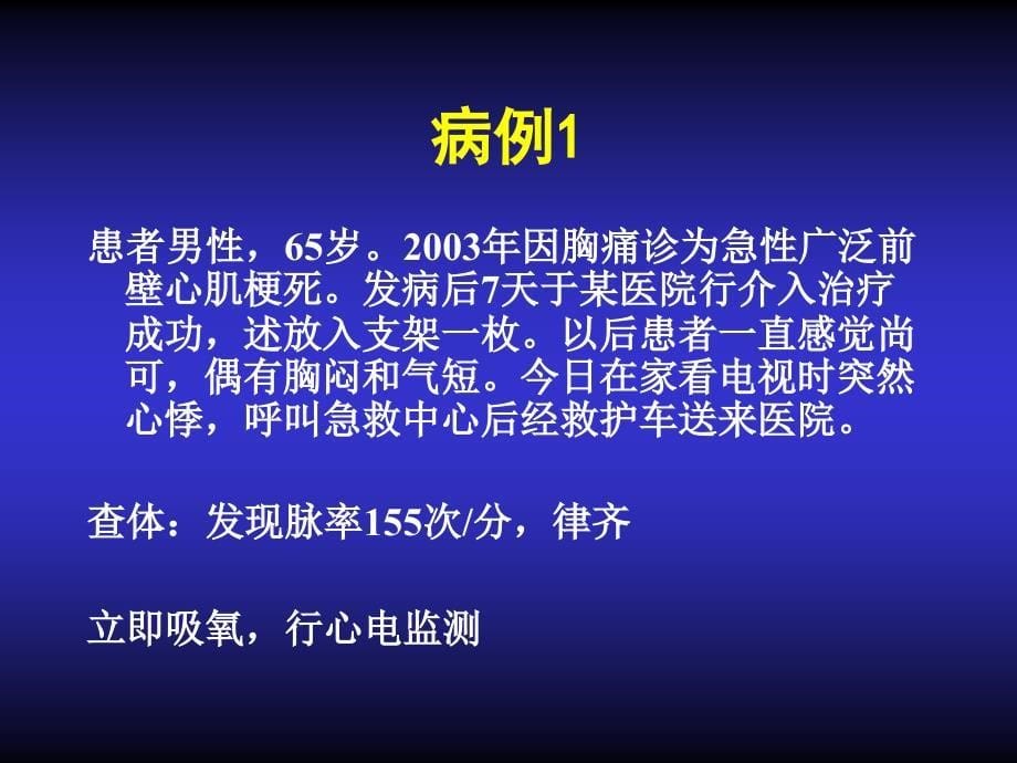 抗心律失常药物的合理应用ppt课件_第5页