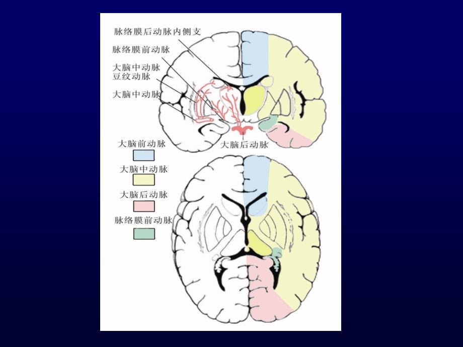 常见疾病病因与治疗方法-脑出血_第4页